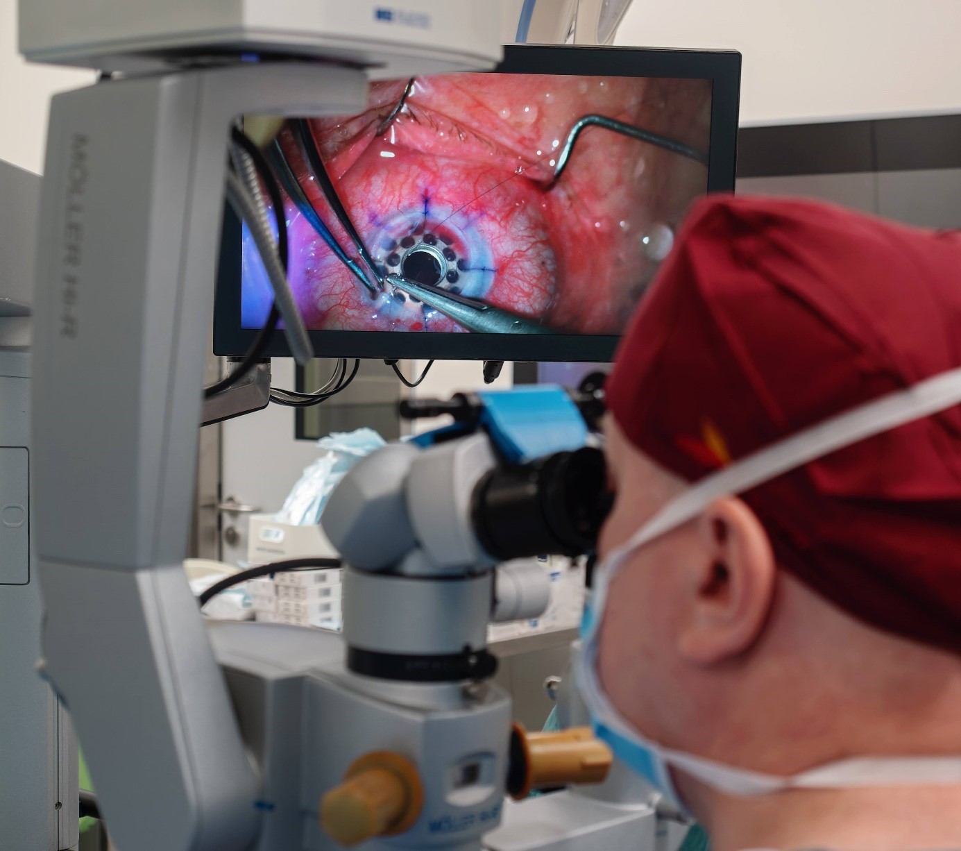 Implantacja keratoprotezy