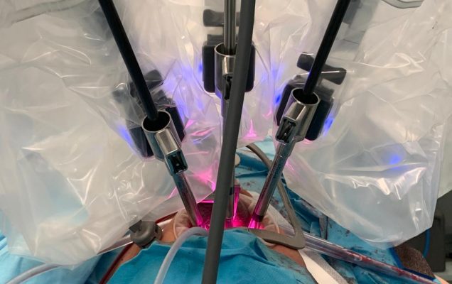 Robot da vinci podczas operacji OBPS w Wojskowym Instytucie Medycznym w Warszawie
