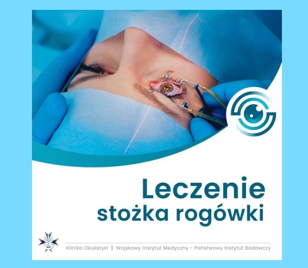 Leczenie stożka rogówki wojskowy instytut badawczy w warszawie
