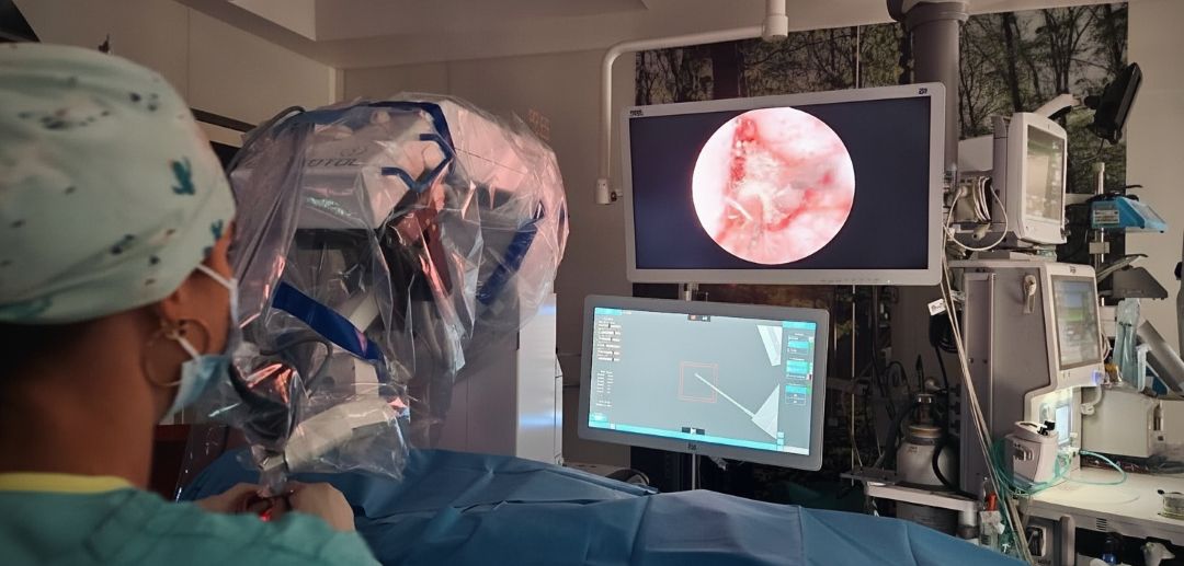 Chirurg przy konsoli robota w trakcie operacji robotycznej.